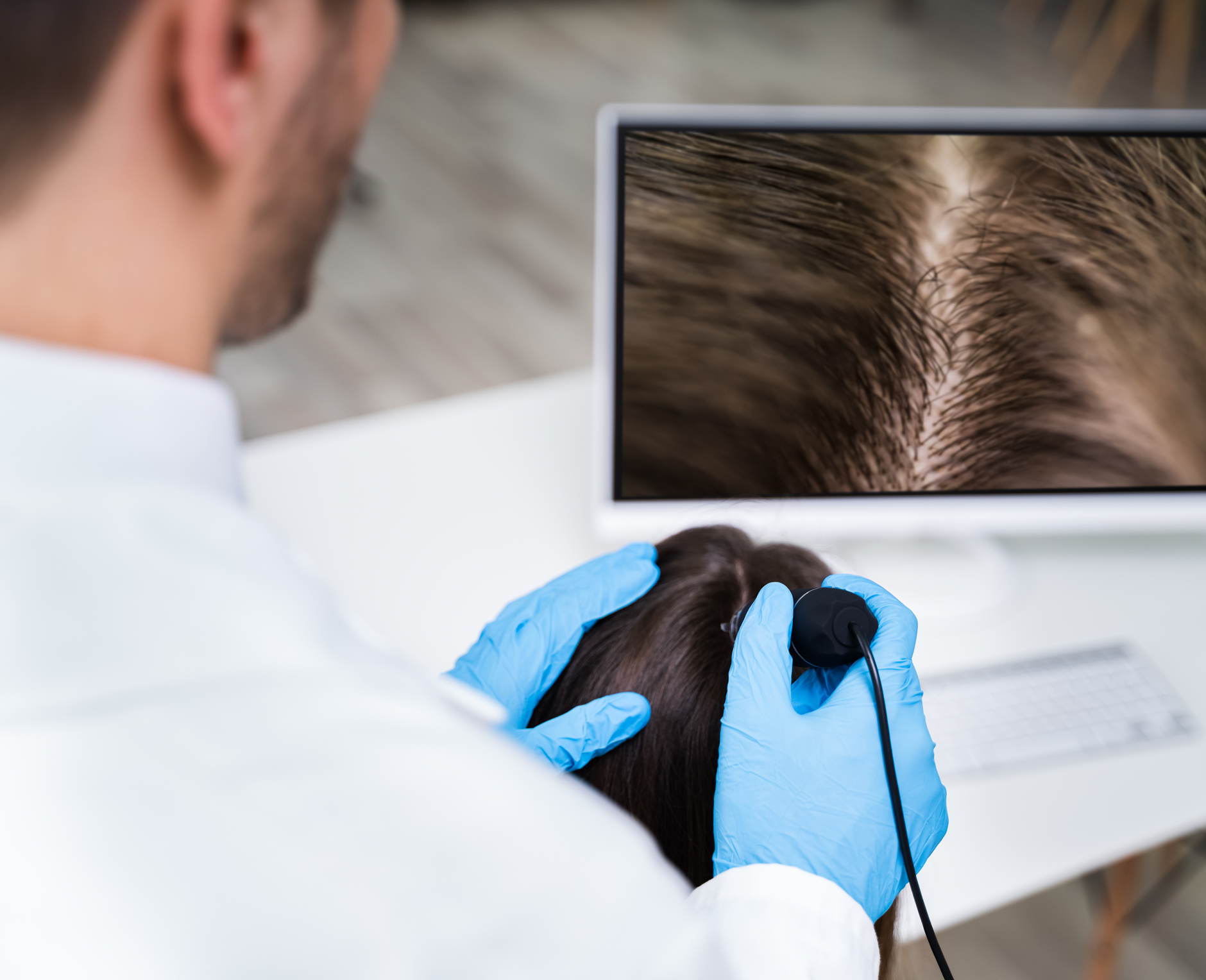 두피진단 이미지